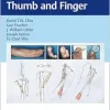 Reconstruction of the Thumb and Finger (EPUB)