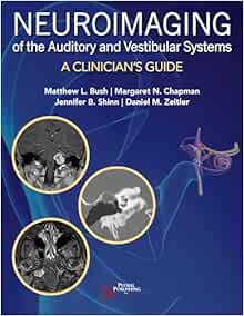 Neuroimaging of the Auditory and Vestibular Systems: A Clinician’s Guide (Original PDF from Publisher)