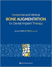 Horizontal and Vertical Bone Augmentation for Dental Implant Therapy (Original PDF from Publisher)