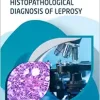 Histopathological Diagnosis Of Leprosy (EPUB)