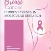 Breast Cancer: Current Trends in Molecular Research (EPUB)