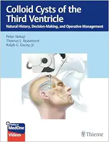 Colloid Cysts of the Third Ventricle: Natural History, Decision-Making, and Operative Management (EPUB)