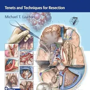 Seven Cavernomas: Tenets and Techniques for Resection (Videos Only)