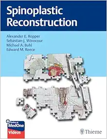 Spinoplastic Reconstruction (Original PDF from Publisher+Videos)