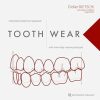 Tooth Wear: Interceptive Treatment Approach With Minimally Invasive Protocols (Original PDF from Publisher)