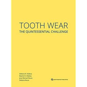 Tooth Wear: The Quintessential Challenge (EPUB)