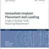 Immediate Implant Placement and Loading: Single or Multiple Teeth Requiring Replacement (EPUB)