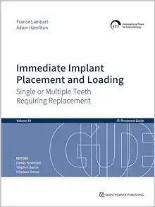 Immediate Implant Placement and Loading: Single or Multiple Teeth Requiring Replacement (EPUB)