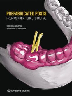 Prefabricated Posts: From Conventional to Digital (EPUB)