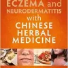 Treating Eczema and Neurodermatitis with Chinese Herbal Medicine (EPUB)