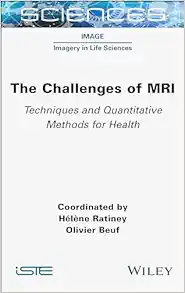 The Challenges of MRI: Techniques and Quantitative Methods for Health (Image: Imagery in Life Sciences) (EPUB)