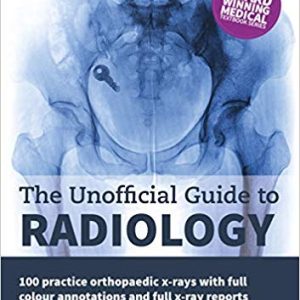 The Unofficial Guide to Radiology: 100 Practice Orthopaedic X Rays with Full Colour Annotations and Full X Ray Reports