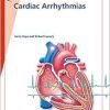 Fast Facts: Cardiac Arrhythmias (EPUB)