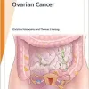 Fast Facts: Ovarian Cancer (Original PDF from Publisher)