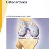 Fast Facts: Osteoarthritis, 3rd Edition (EPUB)