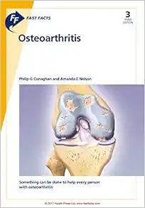 Fast Facts: Osteoarthritis, 3rd Edition (EPUB)