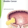 Fast Facts: Bladder Cancer, 3rd edition (EPUB)
