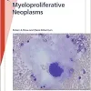Myeloproliferative Neoplasms (Fast Facts) (EPUB)