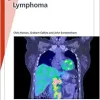 Fast Facts: Lymphoma, 3rd Edition (Original PDF from Publisher)