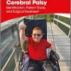 Gait Problems in Cerebral Palsy: Identification, Patient Goals, and Surgical Treatment (Clinics in Developmental Medicine) (Original PDF from Publisher)