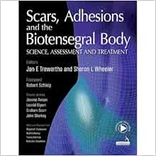 Scars, Adhesions and the Biotensegral Body: Science, Assessment and Treatment (EPUB)