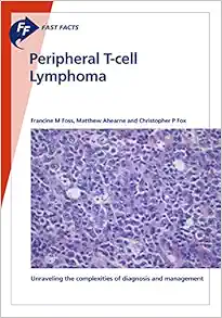 Fast Facts: Peripheral T-cell Lymphoma: Unravelling the: complexities of diagnosis and management (EPUB)