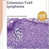Cutaneous T-cell Lymphoma (Fast Facts) (EPUB)