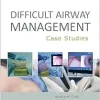 Difficult Airway Management: Case Studies (Original PDF from Publisher)