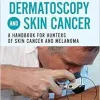 Dermatoscopy and Skin Cancer, updated edition: A handbook for hunters of skin cancer and melanoma (Original PDF from Publisher)
