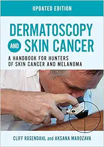 Dermatoscopy and Skin Cancer, updated edition: A handbook for hunters of skin cancer and melanoma (Original PDF from Publisher)