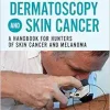 Dermatoscopy and Skin Cancer, updated edition: A handbook for hunters of skin cancer and melanoma (EPUB)