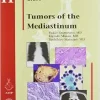 Tumors of the Mediastinum (AFIP Atlas of Tumor Pathology, Series 4, Fascicle 11) (Original PDF from Publisher)