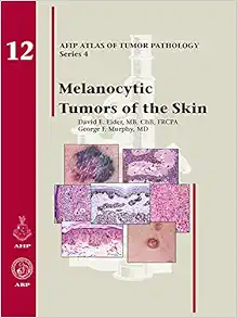 Melanocytic Tumors of the Skin (AFIP Atlas of Tumor Pathology, Fourth Series Fascicle) (Original PDF from Publisher)