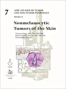 Nonmelanocytic Tumors of the Skin (AFIP Atlas of Tumor and Non-Tumor Pathology, Series 5, Fascicle 7) (Original PDF from Publisher)