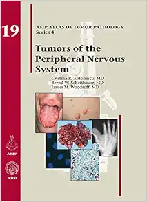 Tumors of the Peripheral Nervous System (AFIP Atlas of Tumor Pathology, Series 4, Fascicle 19) (Original PDF from Publisher)