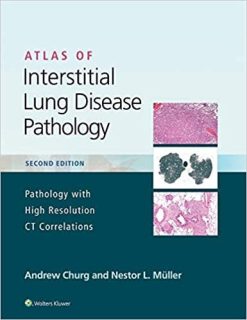 Atlas of Interstitial Lung Disease Pathology, 2ed (Epub)