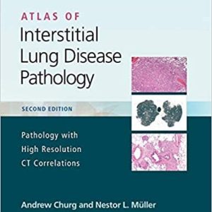 Atlas of Interstitial Lung Disease Pathology, 2ed (Epub)