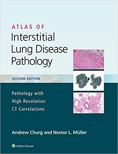 Atlas of Interstitial Lung Disease Pathology, 2ed (Epub)