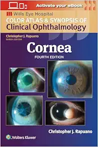 Cornea: Color Atlas and Synopsis of Clinical Ophthalmology (Wills Eye Institute Atlas Series), 4ed (EPUB + Converted PDF)