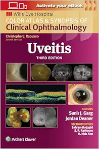 Uveitis: Color Atlas and Synopsis of Clinical Ophthalmology (Wills Eye Institute Atlas Series), 3ed (EPUB + Converted PDF)