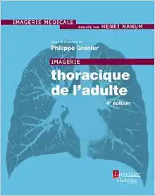 Imagerie Thoracique De L’adulte (French Edition), 4th edition (Original PDF from Publisher)