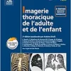 Imagerie Thoracique De L’adulte Et De L’enfant (French Edition), 2nd edition (True PDF)