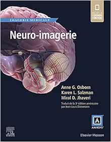 Neuro-imagerie – Collection Imagerie Médicale Amirsys – Osborn (Original PDF from Publisher)