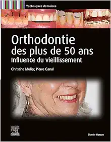Orthodontie des plus de 50 ans: Influence du vieillissement (True PDF From Publisher)