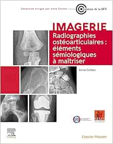 Radiographies ostéoarticulaires : éléments sémiologiques à maitriser (EPUB)