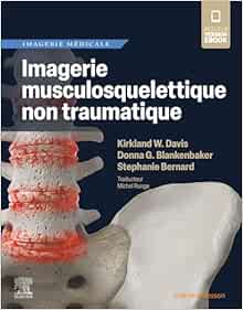 Imagerie musculosquelettique non traumatique (True PDF from Publisher)