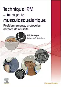 Technique IRM en imagerie musculosquelettique: Positionnements, protocoles, critères de réussite (Original PDF from Publisher)