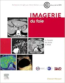 Imagerie du foie (French Edition) (True PDF from Publisher)