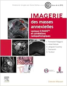 Imagerie des masses annexielles: Lexique O-RADS et corrélations radiopathologiques (Original PDF from Publisher)