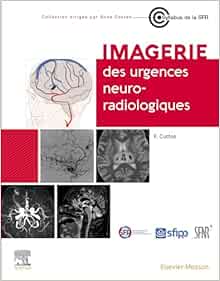 Imagerie des urgences neuroradiologiques (Original PDF from Publisher)